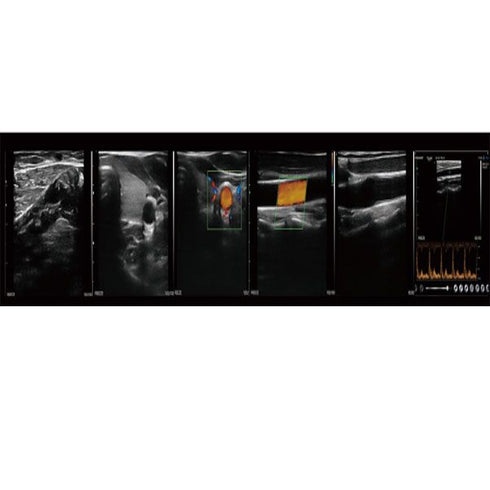 Ecograf ultraportabil wireless C10L45/L25