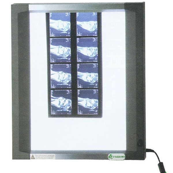 Negatoscop de perete slim | Alexa Medical