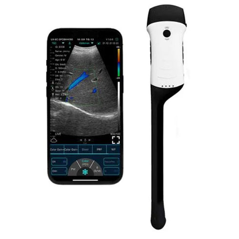 Ecograf ultraportabil wireless C10 RC, convex si endocavitar